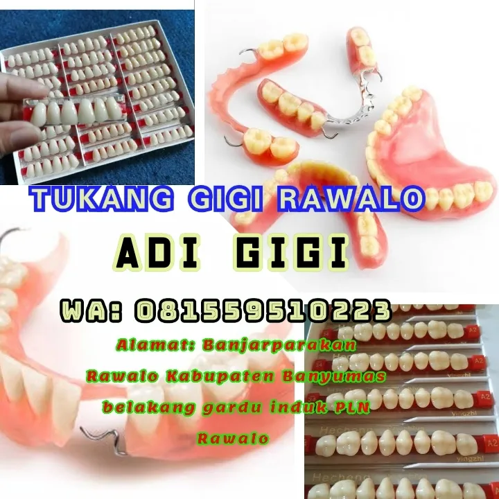 adi gigi purwokerto