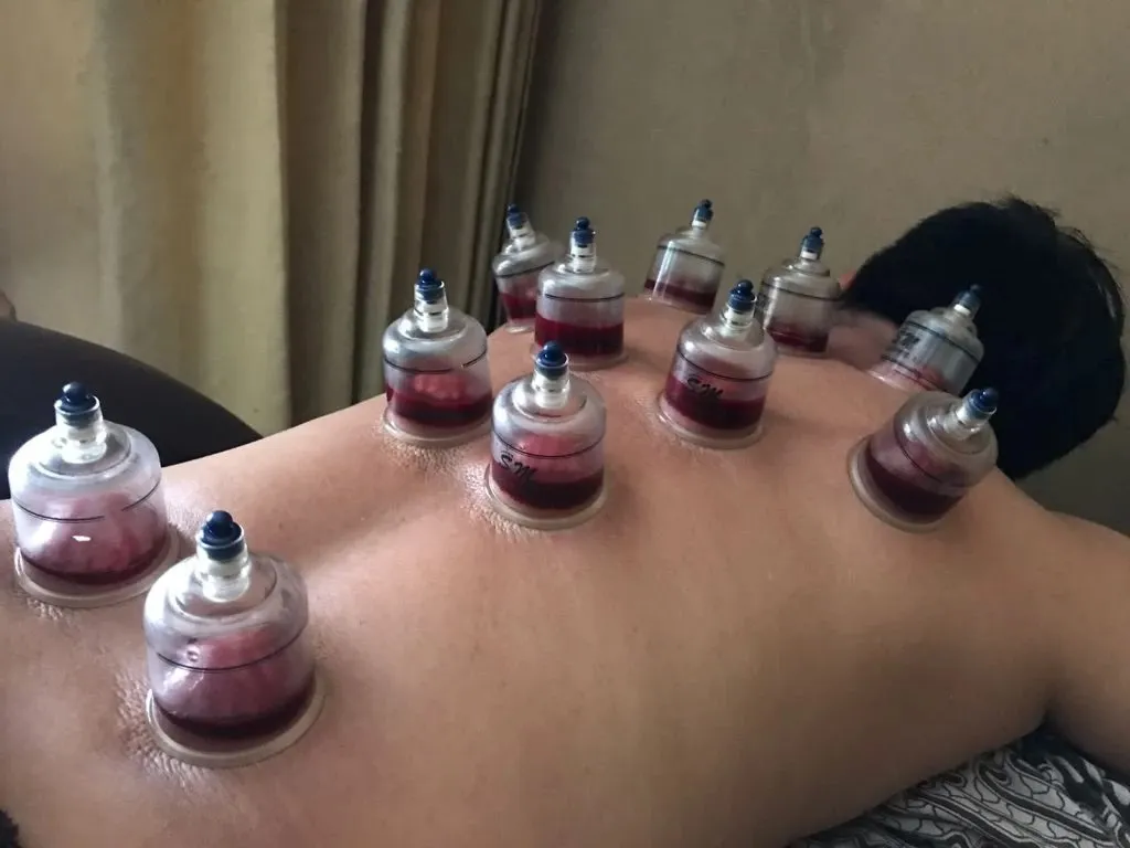 Bekam,Totok dan pijat bu Ati home care