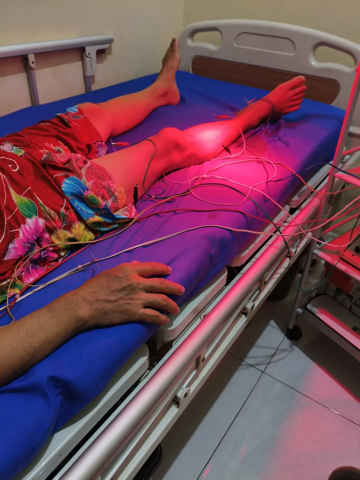 Terapi Akupunktur Aji Prasetyo, A.Md.Akp