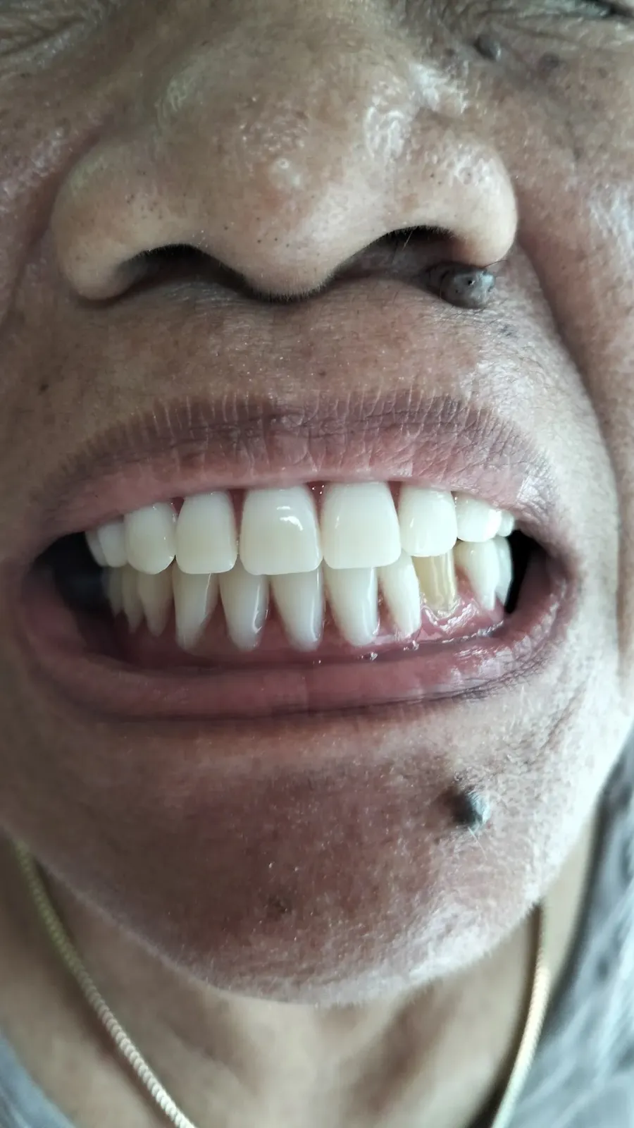 TUKANG GIGI ARTOMORO (EKO RAHMAT)