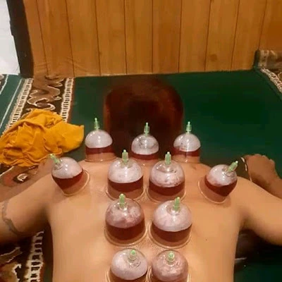 Pijat Urut Tradisional Ibu Rakitem Petahunan