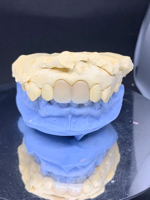 NARATAS DENTAL LABORATORY