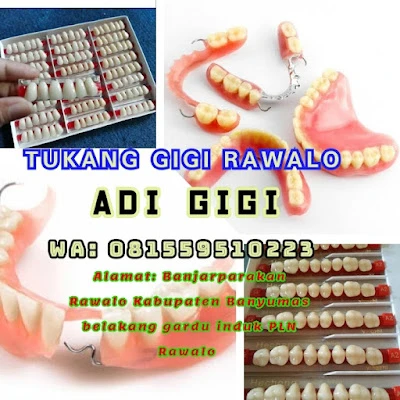 adi gigi purwokerto