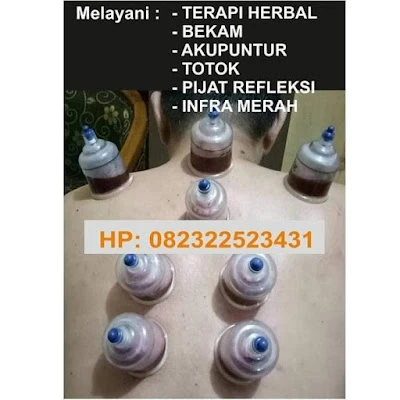 Pengobatan Alternatif Klinik Bekam & Akupuntur Anugerah Herbal