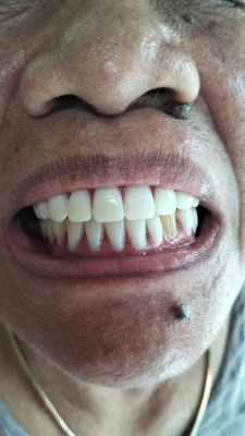 TUKANG GIGI ARTOMORO (EKO RAHMAT)