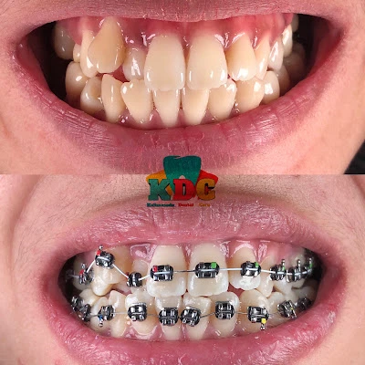 Kalimasada Dental Care Patikraja