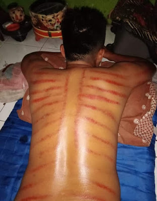 HIDAYAH pijat urut dan terapi