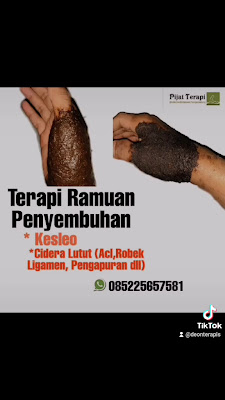 MCO Purbalingga (Massage Cidera Olahraga) Purbalingga