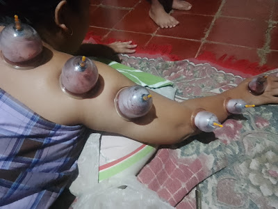 Pijat urut bekam gurah suara
