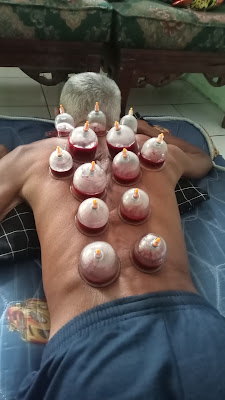 TERAPI BEKAM & GURAH