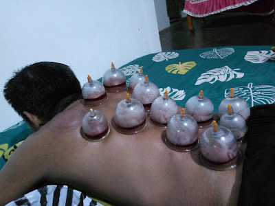 Terapi Pijat Tradisional Moderen,Bekam,Gurah Hidung (Mas ROCHMAN)👉terima panggilan