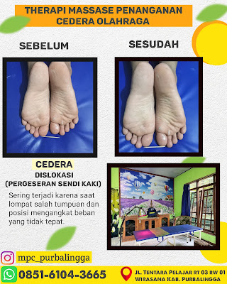 Therapi MPC (Pijat / Masas Cedera Olahraga)